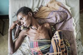 Zimbabwe Sees Alarming Rise in HIV/AIDS-Related Deaths