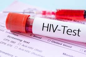 Bulawayo Makes Significant Strides in HIV Control but Faces Ongoing Challenges, New Report Reveals